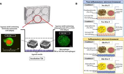 The obese inflammatory microenvironment may promote breast DCIS progression